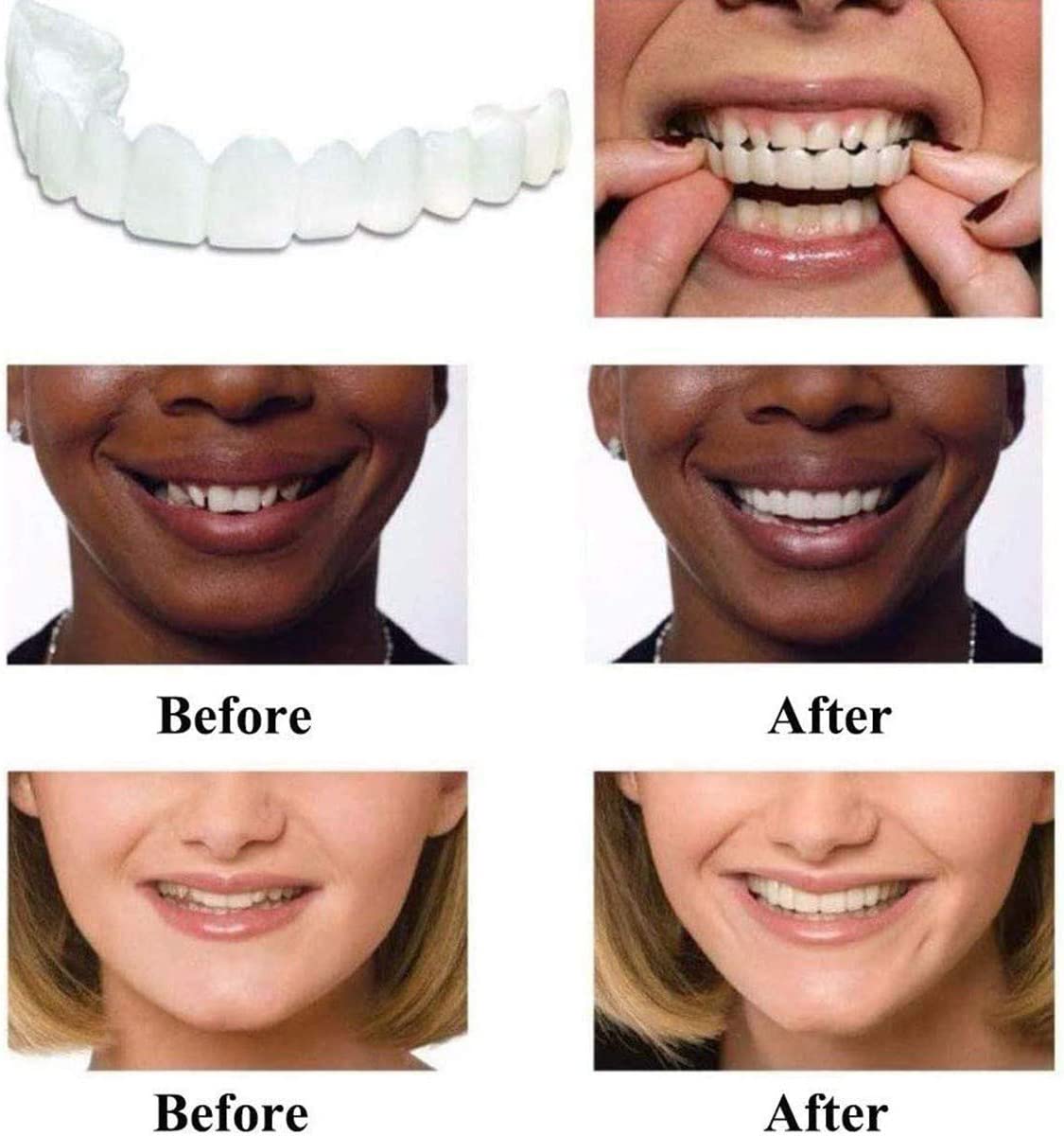 Teeth Veneers Smile Veneers, Instant Smile Comfort Fit Flex Cosmetic Teeth Top Cosmetic Veneer, for Disguise Crooked Stained Missing and Gapped Teeth2 Pair (Upper Teeth + Lower Teeth)