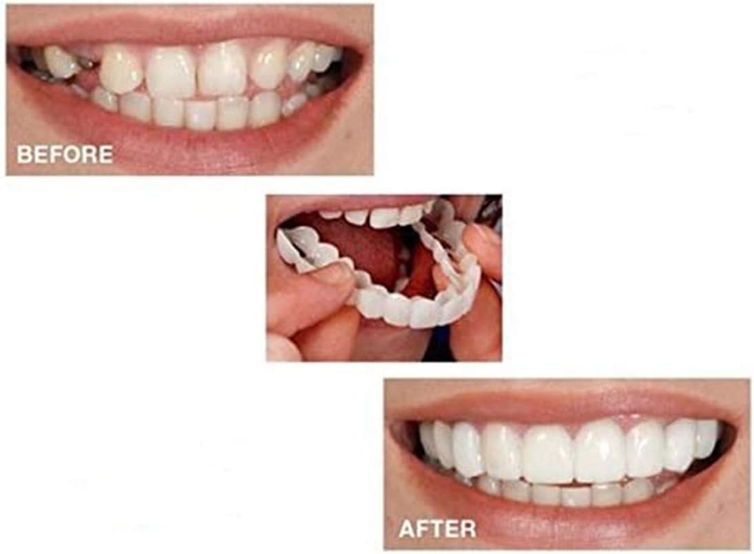 Teeth Veneers Smile Veneers, Instant Smile Comfort Fit Flex Cosmetic Teeth Top Cosmetic Veneer, for Disguise Crooked Stained Missing and Gapped Teeth2 Pair (Upper Teeth + Lower Teeth)