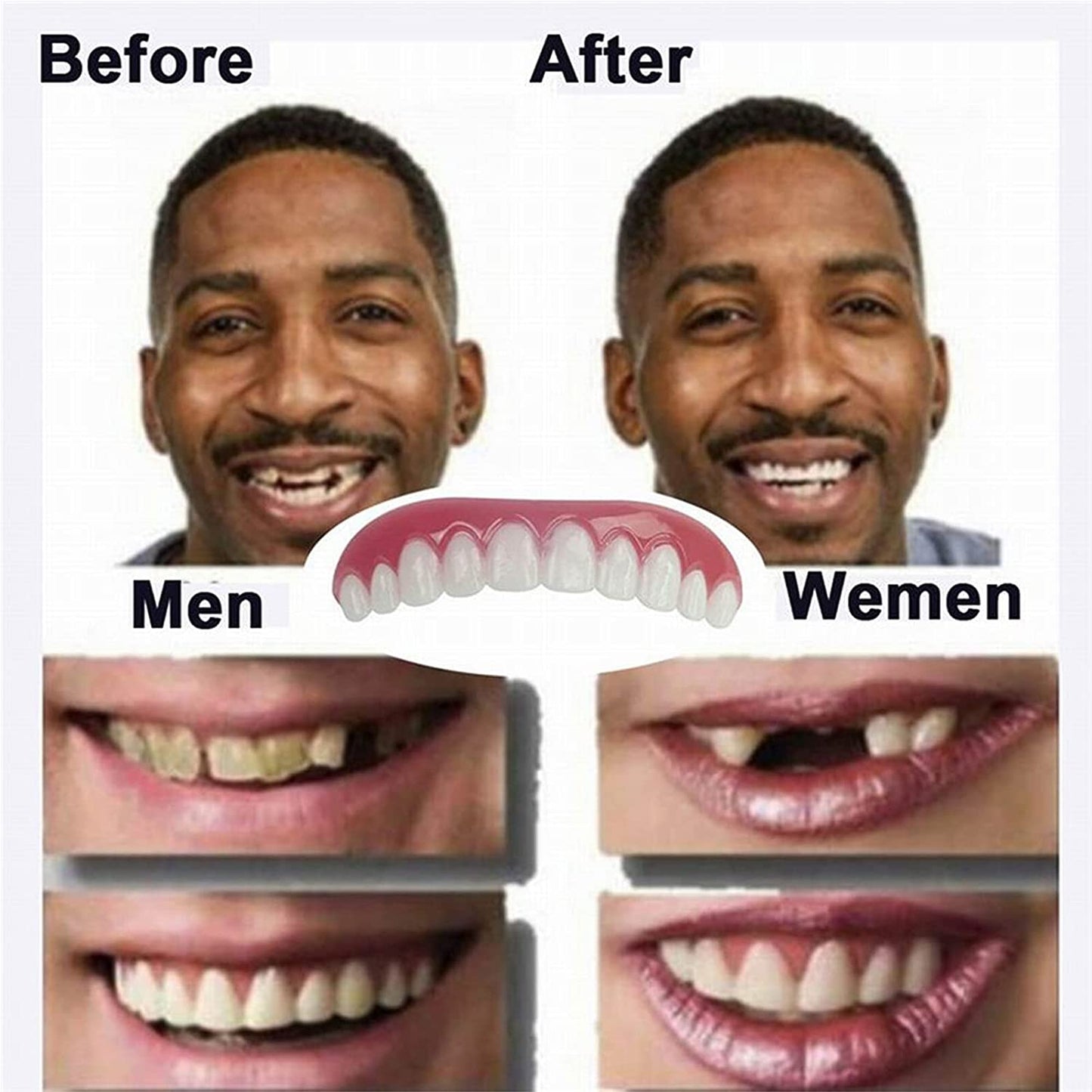 GHJGDAOM Immediate Veneer Upper and Lower False Teeth Natural Tone Comfortable Flexible Perfect Veneers Cosmetic Teeth Silica Gel Fit Perfect Teeth Stickers and Whitening Alternative,6 Pairs